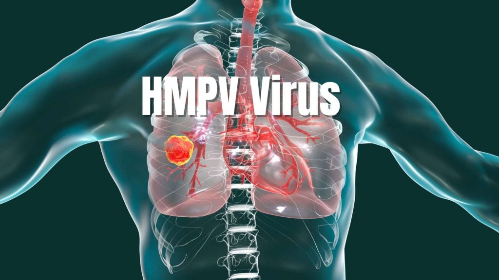 hMPV: alta na circulação de vírus respiratório na China acende alerta